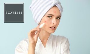 10 Ciri-Ciri Tidak Cocok Memakai Serum Scarlett Acne